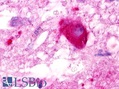 LPAR5 / GPR92 Antibody - Brain, hypothalamus