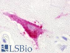 LPAR5 / GPR92 Antibody - Brain, Cortex, Neuron