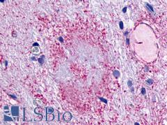 LPAR5 / GPR92 Antibody - Brain, Alzheimer's disease senile plaque