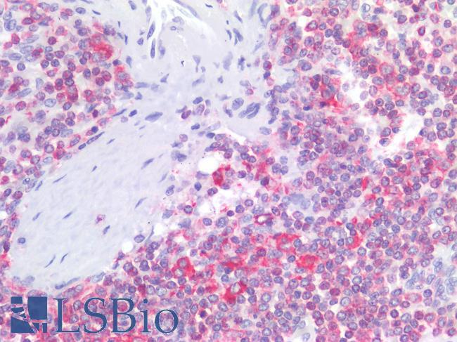 LSP1 Antibody - Human Spleen: Formalin-Fixed, Paraffin-Embedded (FFPE)