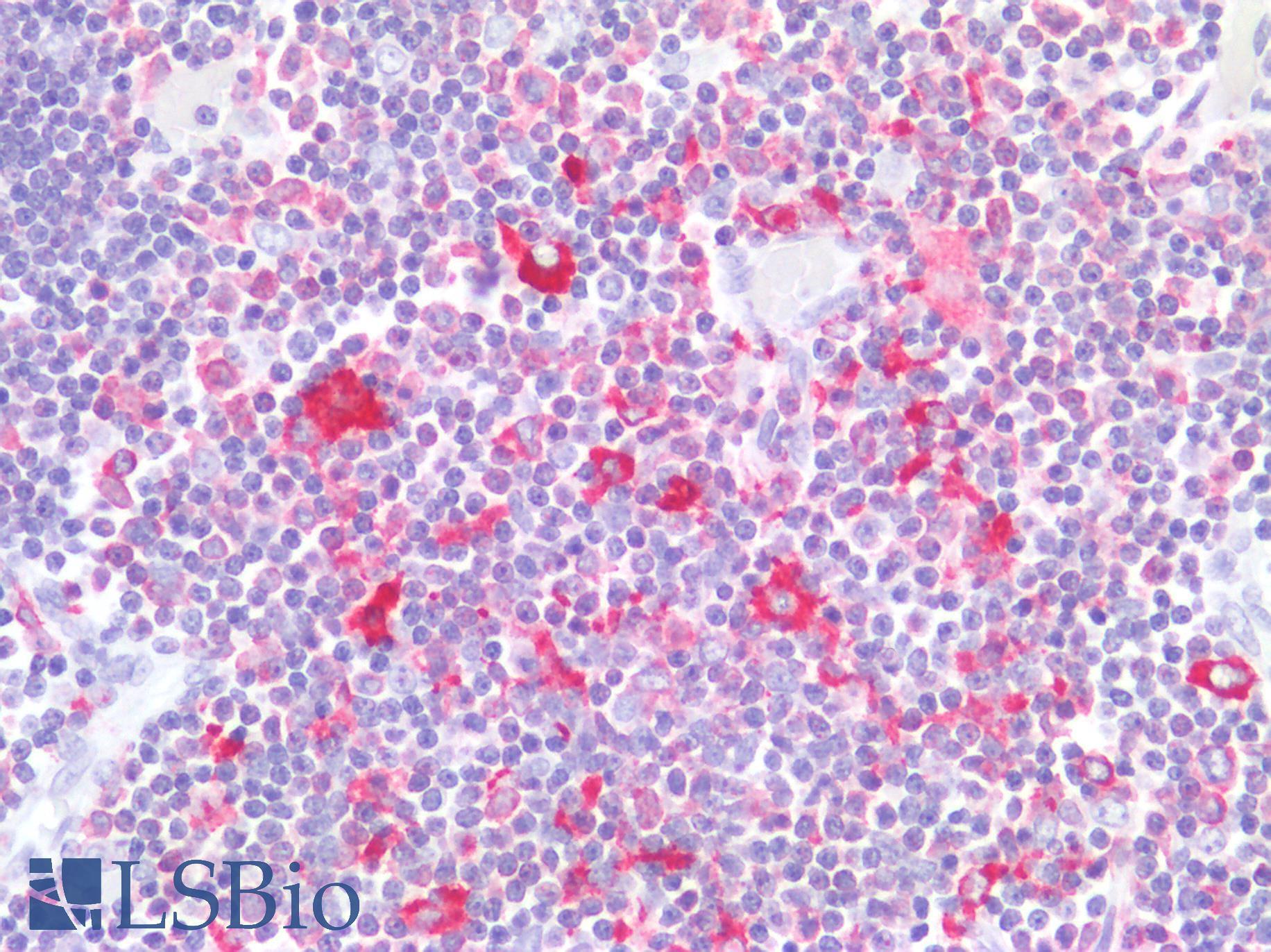 LSP1 Antibody - Human Thymus: Formalin-Fixed, Paraffin-Embedded (FFPE)