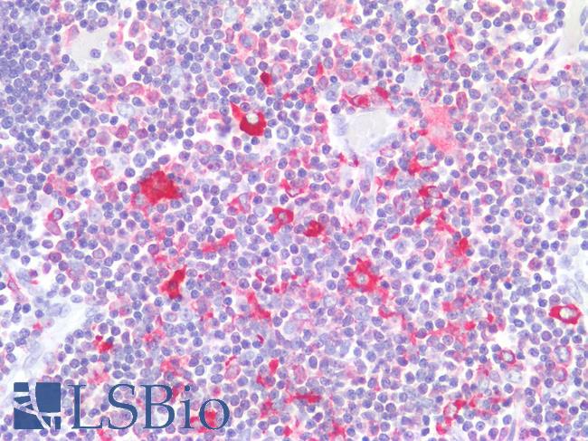 LSP1 Antibody - Human Thymus: Formalin-Fixed, Paraffin-Embedded (FFPE)