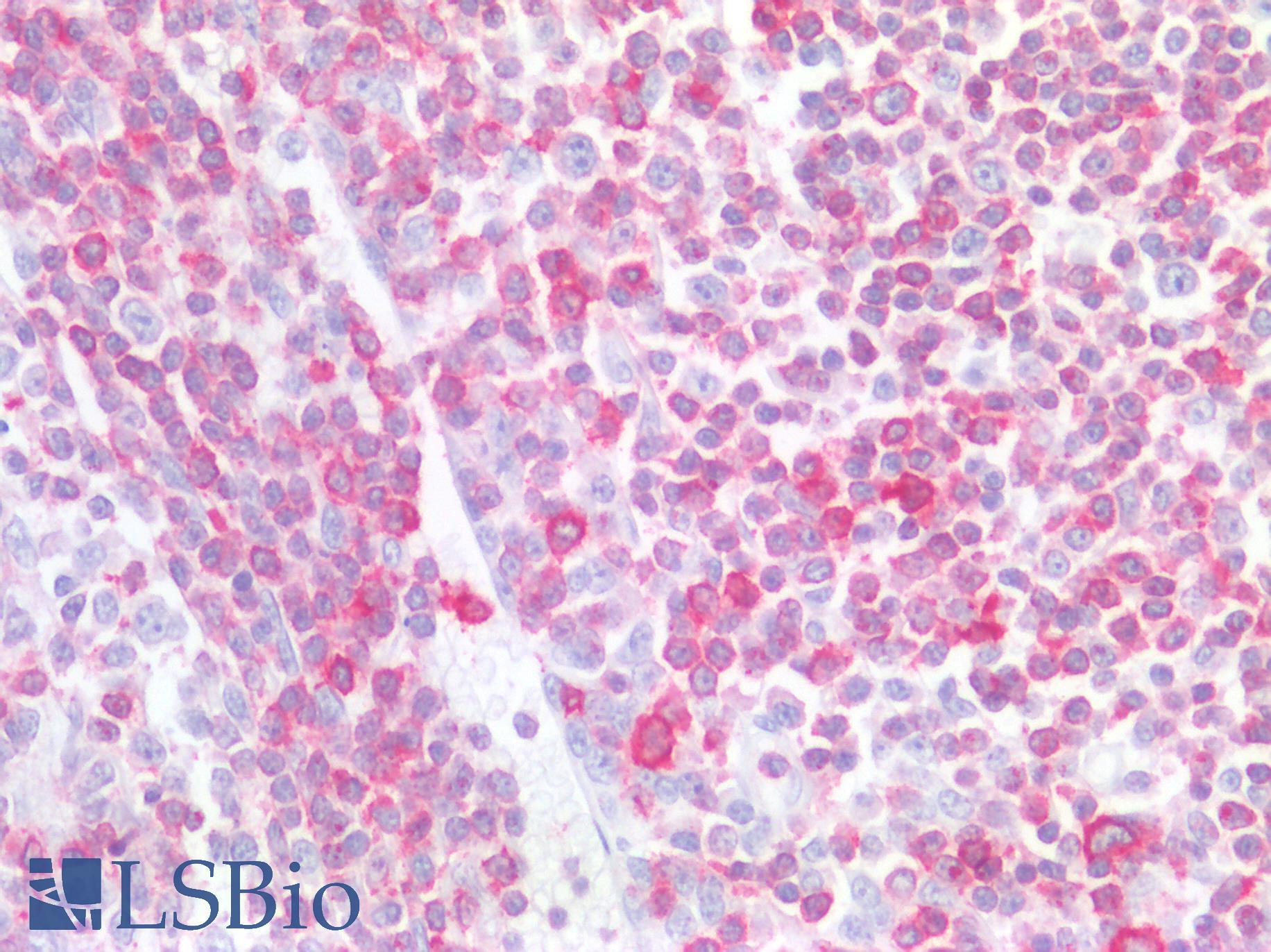 LSP1 Antibody - Human Tonsil: Formalin-Fixed, Paraffin-Embedded (FFPE)