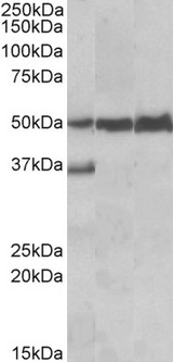 LSP1 Antibody - Goat Anti-LSP1 Antibody (0.05µg/ml) staining of Human Liver lysate (lane 1), Mouse Liver lysate (lane 2) and Rat Liver lysate (lane 3) (35µg protein in RIPA buffer). Primary incubation was 1 hour. Detected by chemiluminescencence.