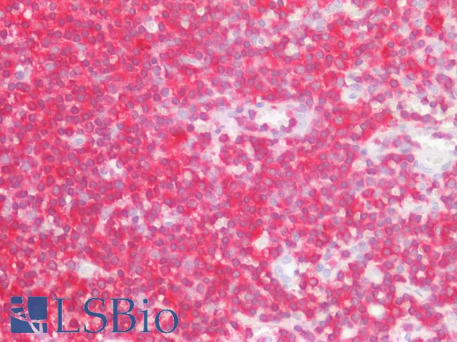 LSP1 Antibody - Human Tonsil: Formalin-Fixed, Paraffin-Embedded (FFPE)