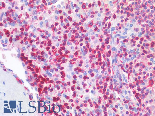 LSP1 Antibody - Human Spleen: Formalin-Fixed, Paraffin-Embedded (FFPE)