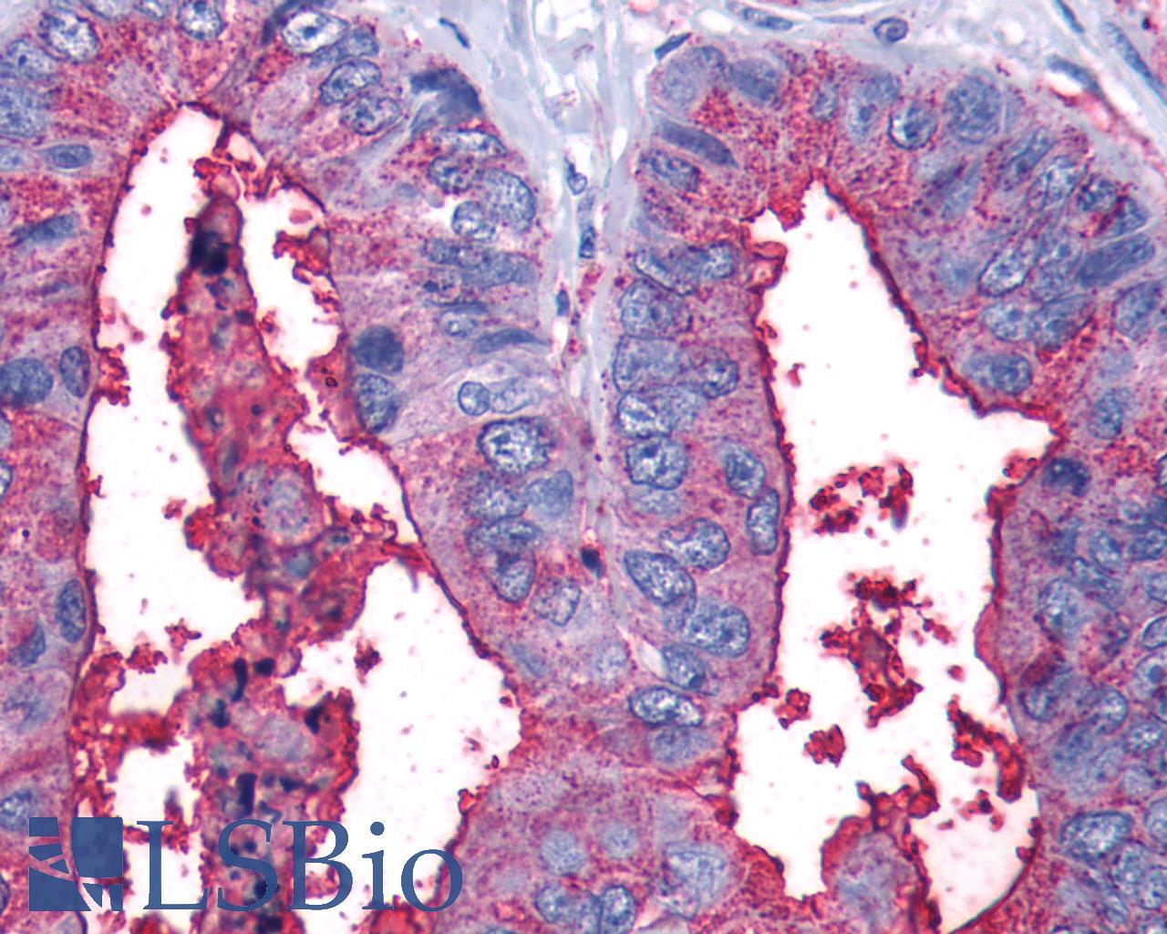 LTB4R2 / BLT2 Antibody - Colon, carcinoma