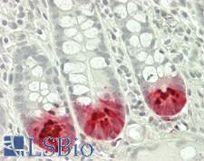 LYZ / Lysozyme Antibody - Human Small Intestine: Formalin-Fixed, Paraffin-Embedded (FFPE)