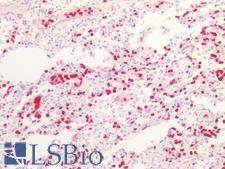 Macrophage Antibody - Human Lung: Formalin-Fixed, Paraffin-Embedded (FFPE)