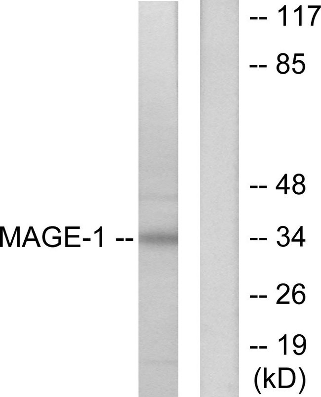 MAGEA1 / MAGE 1 Antibody - Western blot analysis of lysates from HepG2 cells, using MAGE-1 Antibody. The lane on the right is blocked with the synthesized peptide.