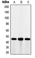 MAGEA1 / MAGE 1 Antibody - Western blot analysis of MAGEA1 expression in HT29 (A); A375 (B); Jurkat (C) whole cell lysates.