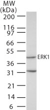 MAPK3 / ERK1 Antibody - Western blot of ERK1 in human A431 cell lysate using antibody at 1 ug/ml.