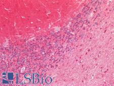 MAPT / Tau Antibody - Human Brain, Cerebellum: Formalin-Fixed, Paraffin-Embedded (FFPE)