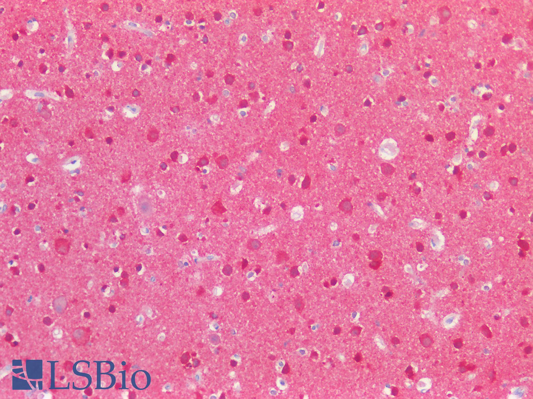 MAPT / Tau Antibody - Human Brain, Cortex: Formalin-Fixed, Paraffin-Embedded (FFPE)