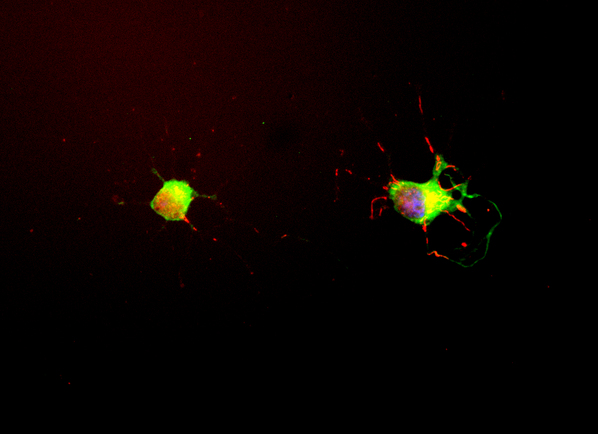MAPT / Tau Antibody - Standard immunostaining protocol (green), chicken antibody to alpha-internexin (red) and for DNA (blue). MAPT / TAU antibody stains the neuronal perikarya and process strongly, and does not stain non-neuronal cells in these cultures. The alpha-internexin antibody stains intermediate or 10nm filament bundles in the cytoplasm of these cells.