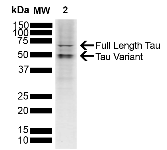 MAPT / Tau Antibody - Western blot analysis of Human SH-SY5Y cell lysate showing detection of ~45.8 kDa Tau protein using Rabbit Anti-Tau Polyclonal Antibody. Lane 1: Molecular Weight Ladder (MW). Lane 2: Human SH-SY5Y cell lysate. Load: 10 µg. Block: 5% Skim Milk powder in TBST. Primary Antibody: Rabbit Anti-Tau Polyclonal Antibody  at 1:1000 for 2 hours at RT with shaking. Secondary Antibody: Goat anti-rabbit IgG:HRP at 1:4000 for 1 hour at RT with shaking. Color Development: Chemiluminescent for HRP (Moss) for 5 min in RT. Predicted/Observed Size: ~45.8 kDa. Other Band(s): 50 kDa, 65 kDa.
