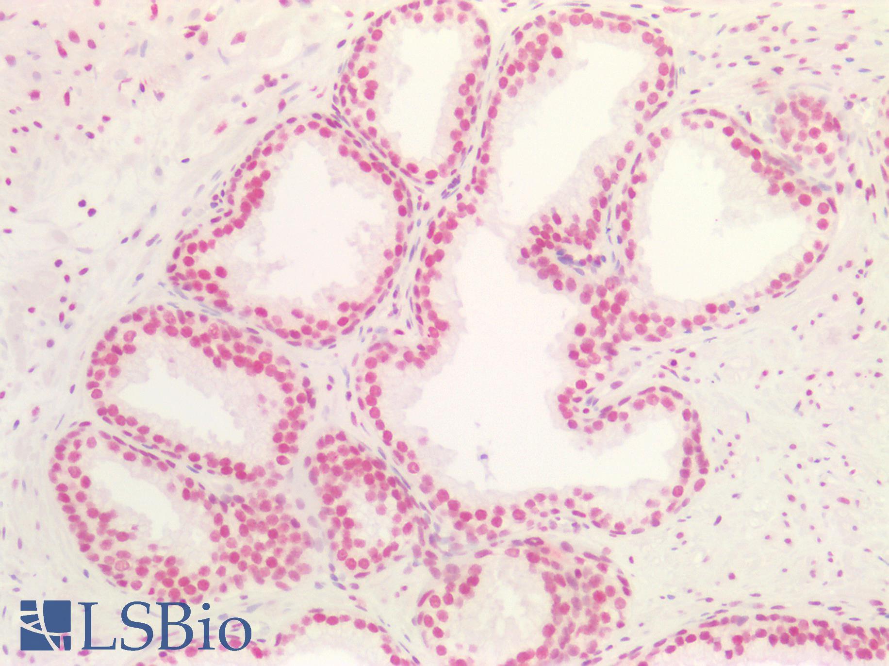MAX Antibody - Human Prostate: Formalin-Fixed, Paraffin-Embedded (FFPE)