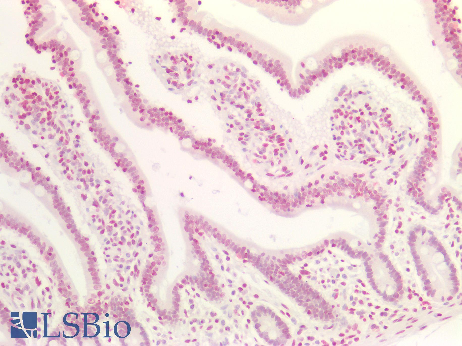 MAX Antibody - Human Small Intestine: Formalin-Fixed, Paraffin-Embedded (FFPE)