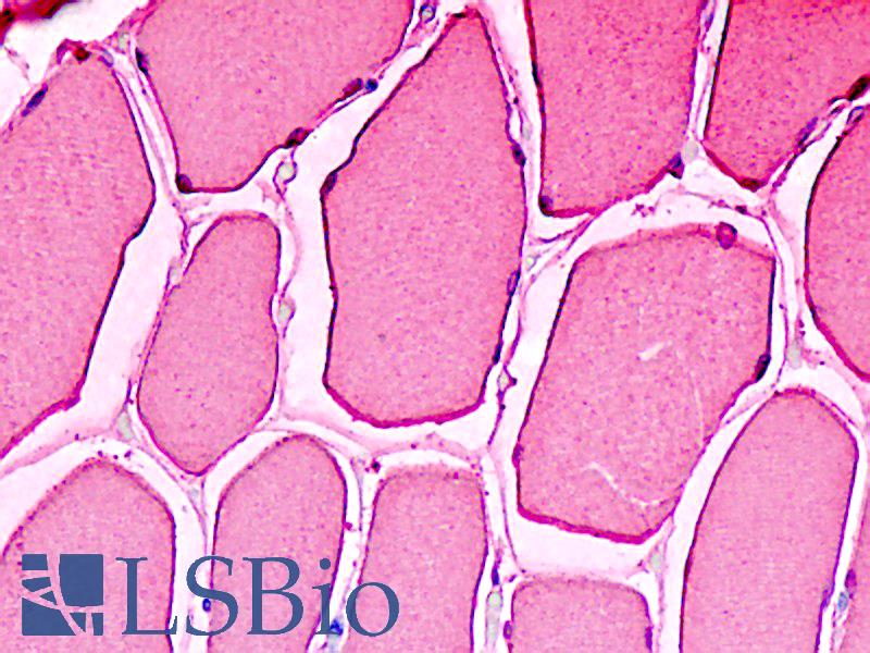 MB / Myoglobin Antibody - Anti-MB / Myoglobin antibody IHC staining of human skeletal muscle. Immunohistochemistry of formalin-fixed, paraffin-embedded tissue after heat-induced antigen retrieval.