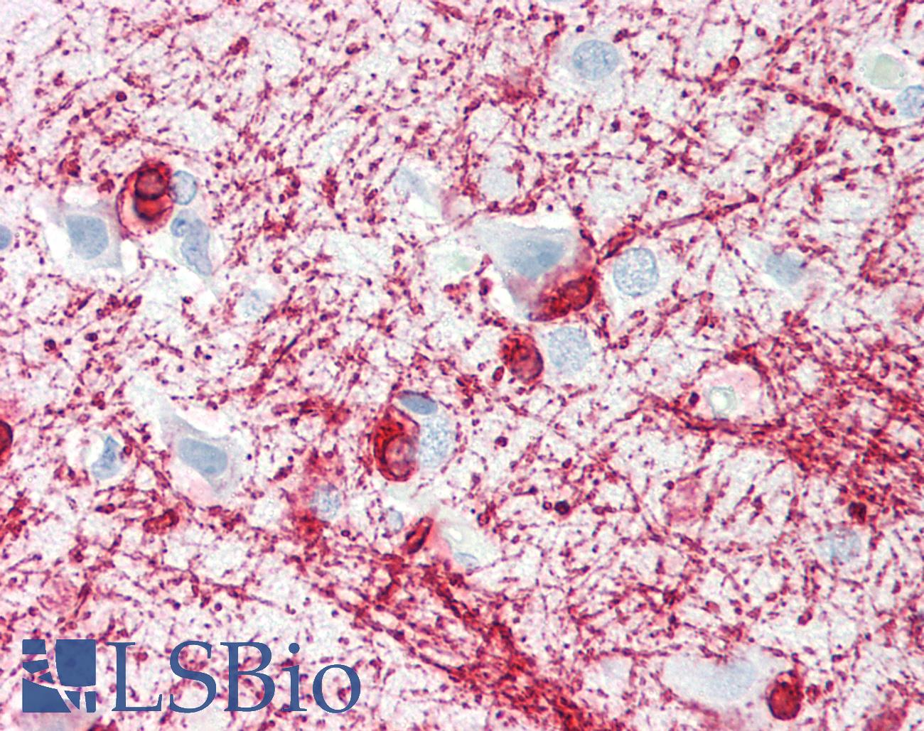 MBP / Myelin Basic Protein Antibody - Human Cortex: Formalin-Fixed, Paraffin-Embedded (FFPE)