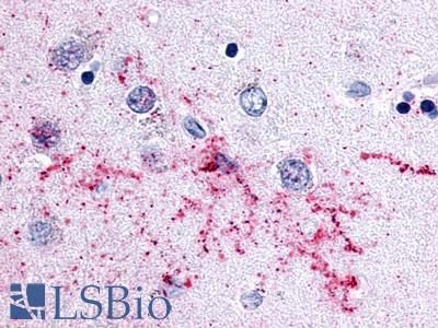 MCHR2 Antibody - Brain, Caudate, neurons and glia