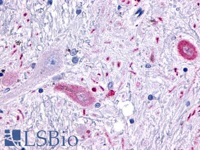 MCHR2 Antibody - Brain, Putamen, neurons and glia