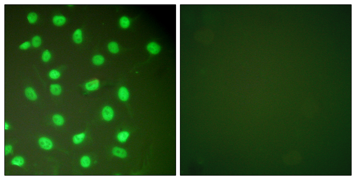 MCM2 Antibody - Immunofluorescence analysis of HepG2 cells, using MCM2 Antibody. The picture on the right is blocked with the synthesized peptide.
