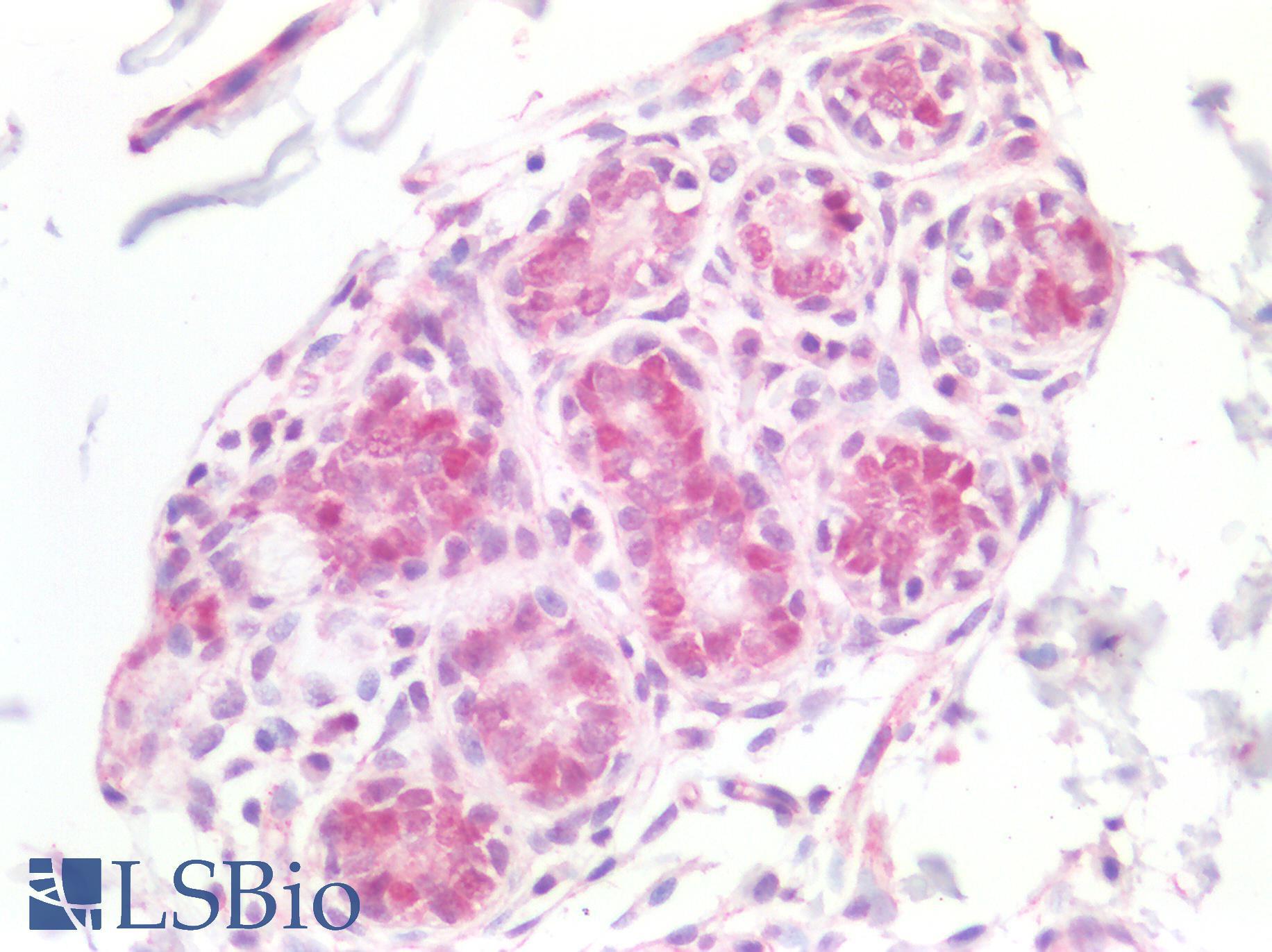 MCM5 Antibody - Human Breast: Formalin-Fixed, Paraffin-Embedded (FFPE)