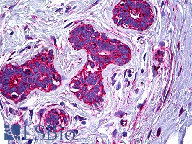 Melanoma Antigen NKI/C3 Antibody - Anti-NKI/C3 antibody IHC of human breast. Immunohistochemistry of formalin-fixed, paraffin-embedded tissue after heat-induced antigen retrieval. Antibody dilution 1:100.