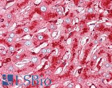 Melanoma-Associated Antigen Antibody - Anti-Melanoma-Associated Antigen antibody IHC of human liver. Immunohistochemistry of formalin-fixed, paraffin-embedded tissue after heat-induced antigen retrieval. Antibody concentration 10 ug/ml.
