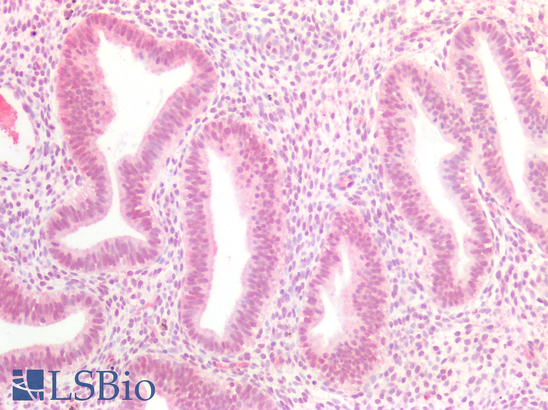 MEN1 / Menin Antibody - Human Uterus: Formalin-Fixed, Paraffin-Embedded (FFPE)