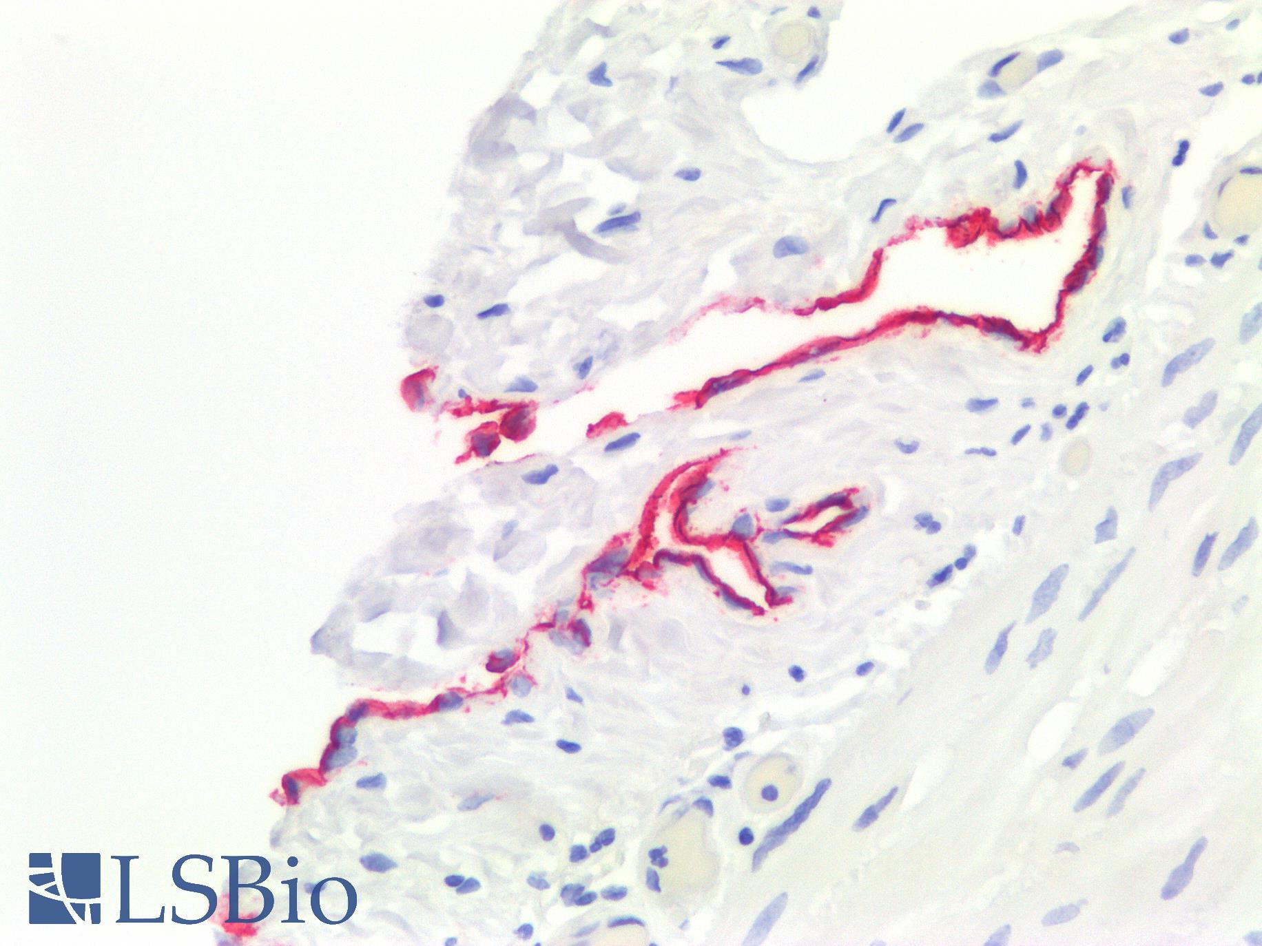 Mesothelioma Antibody - Human Small Intestine: Formalin-Fixed, Paraffin-Embedded (FFPE)