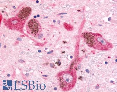 MINK1 / MINK Antibody - Brain, substantia nigra