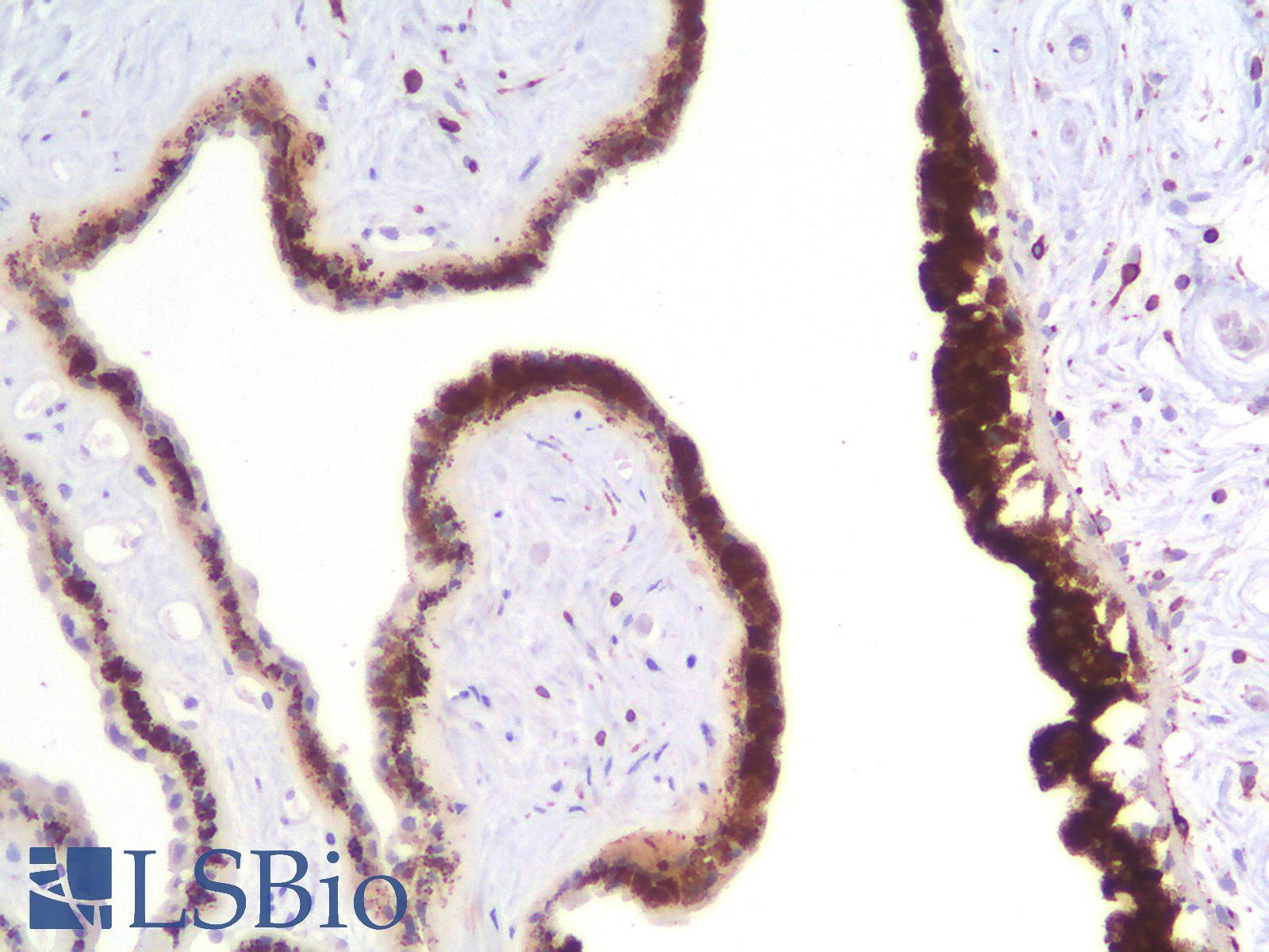 MLANA / Melan-A Antibody - Human Skin: Formalin-Fixed, Paraffin-Embedded (FFPE)