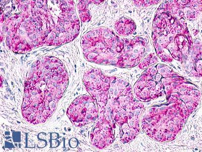 MLNR/GPR38/Motilin Receptor Antibody - Breast, Carcinoma