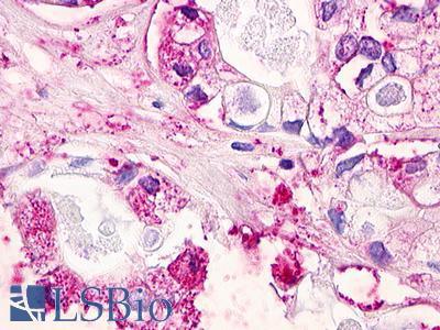MLNR/GPR38/Motilin Receptor Antibody - Pancreas, Carcinoma