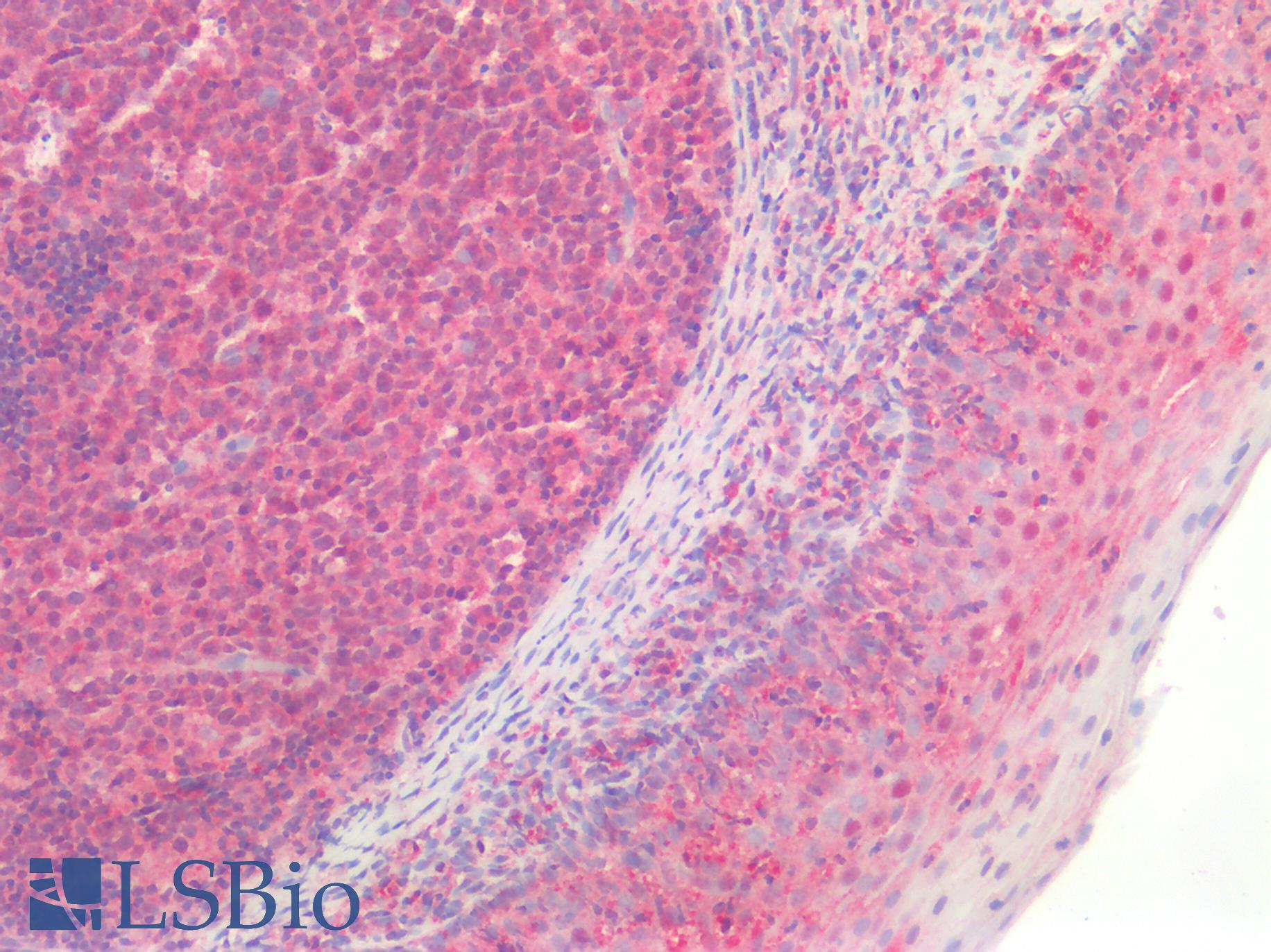 MLPH / Melanophilin Antibody - Human Tonsil: Formalin-Fixed, Paraffin-Embedded (FFPE)
