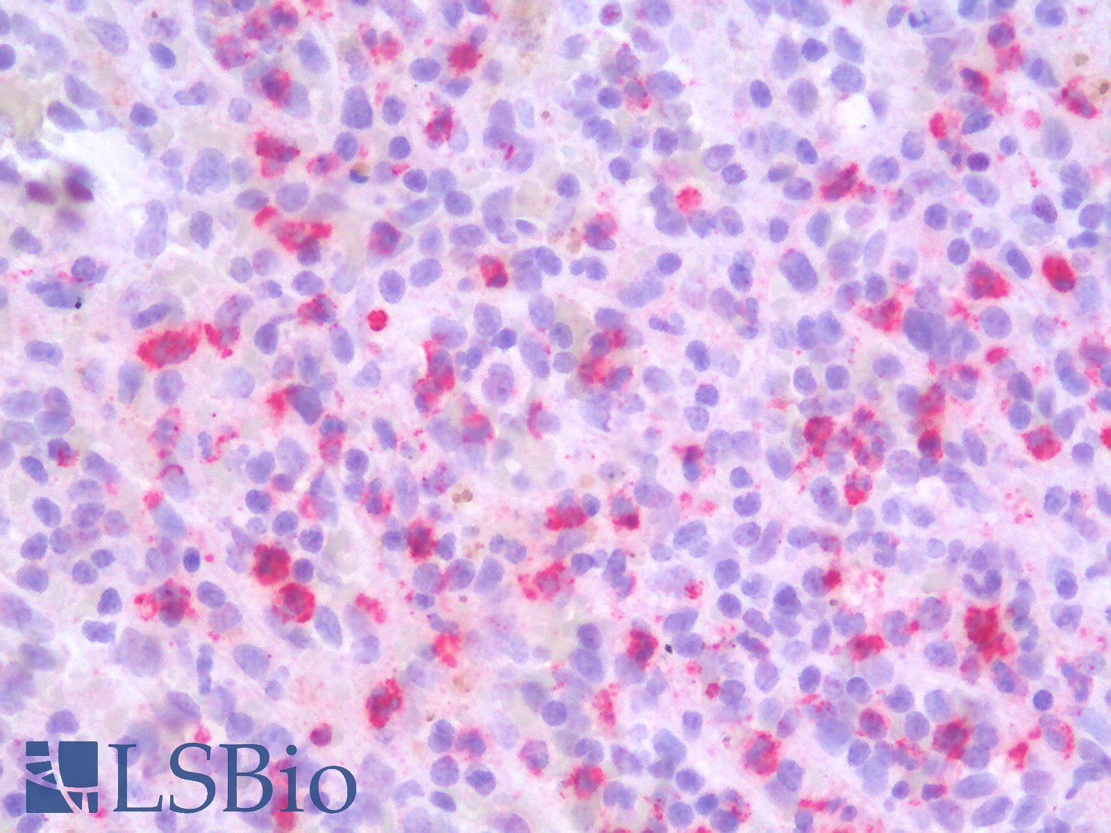 MMP9 / Gelatinase B Antibody - Human Spleen: Formalin-Fixed, Paraffin-Embedded (FFPE)