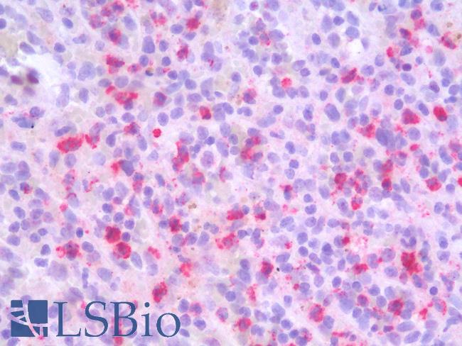 MMP9 / Gelatinase B Antibody - Human Spleen: Formalin-Fixed, Paraffin-Embedded (FFPE)