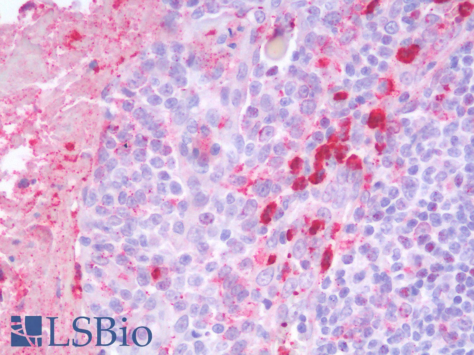 MMP9 / Gelatinase B Antibody - Human Tonsil: Formalin-Fixed, Paraffin-Embedded (FFPE)