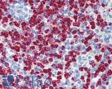 MPO / Myeloperoxidase Antibody - Anti-MPO / Myeloperoxidase antibody IHC of human spleen. Immunohistochemistry of formalin-fixed, paraffin-embedded tissue after heat-induced antigen retrieval. Antibody dilution 1:200.