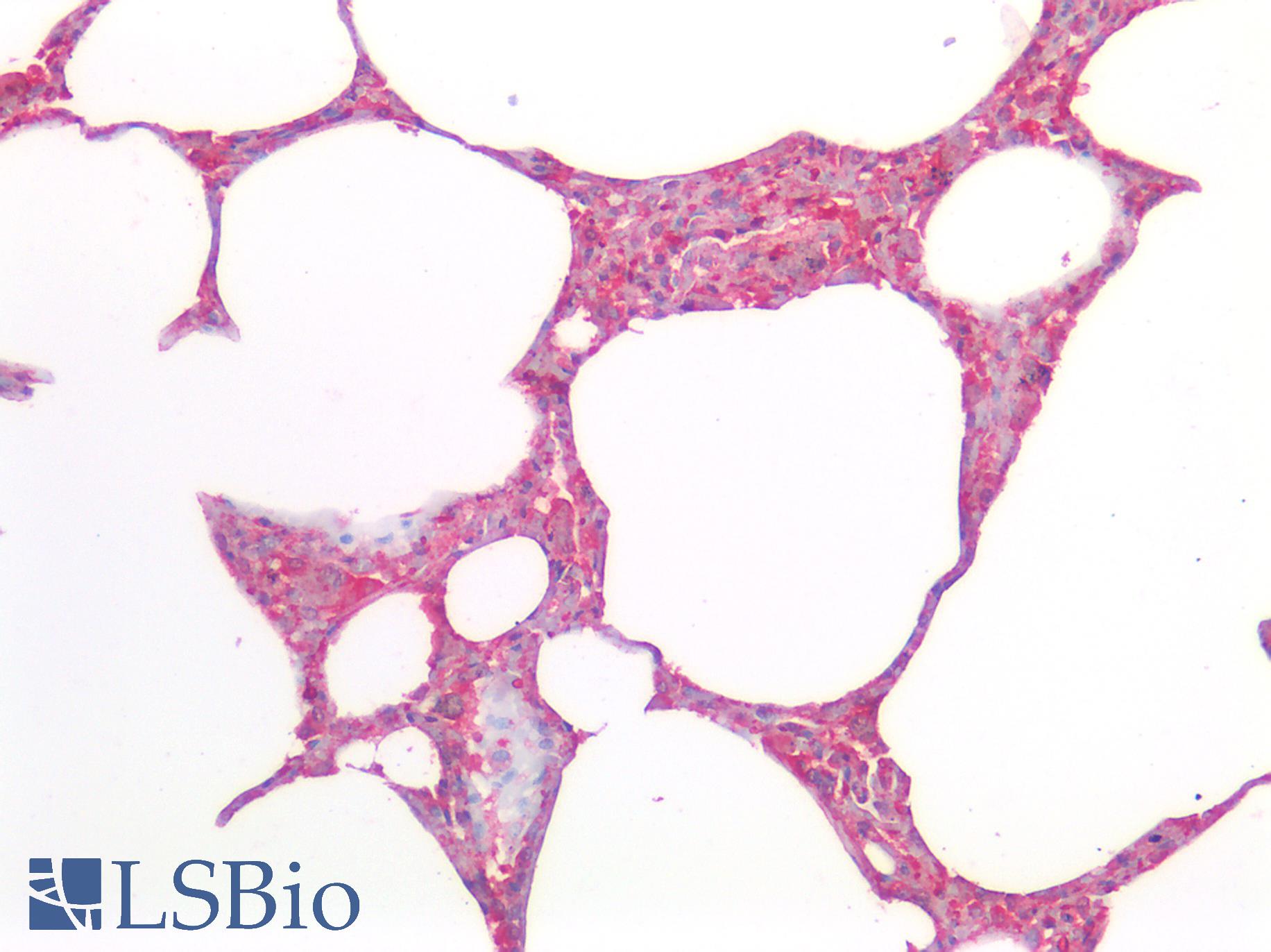 MRGPRX2 / MRGX2 Antibody - Human Lung: Formalin-Fixed, Paraffin-Embedded (FFPE)