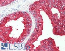 MSMB / MSP Antibody - Human Prostate: Formalin-Fixed, Paraffin-Embedded (FFPE)