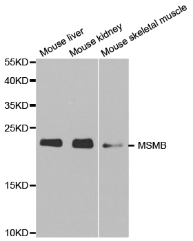 MSMB / MSP Antibody - Western blot analysis of extracts of various cell lines.