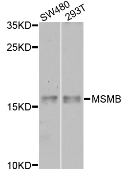 MSMB / MSP Antibody - Western blot analysis of extracts of various cell lines, using MSMB antibody at 1:1000 dilution. The secondary antibody used was an HRP Goat Anti-Rabbit IgG (H+L) at 1:10000 dilution. Lysates were loaded 25ug per lane and 3% nonfat dry milk in TBST was used for blocking. An ECL Kit was used for detection and the exposure time was 60s.