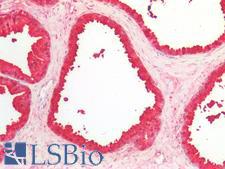 MSMB / MSP Antibody - Human Prostate: Formalin-Fixed, Paraffin-Embedded (FFPE)