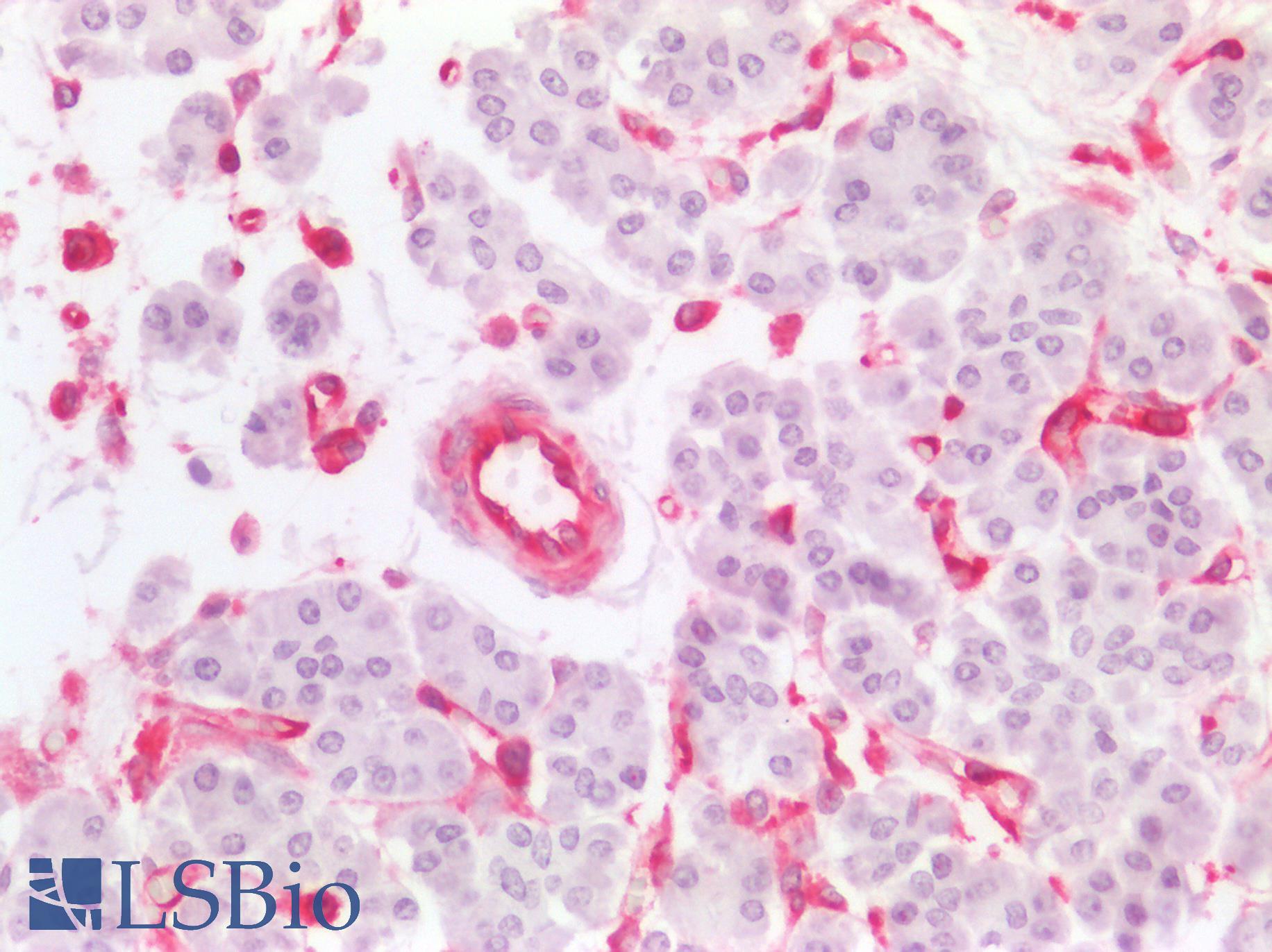 MSN / Moesin Antibody - Human Pancreas: Formalin-Fixed, Paraffin-Embedded (FFPE)