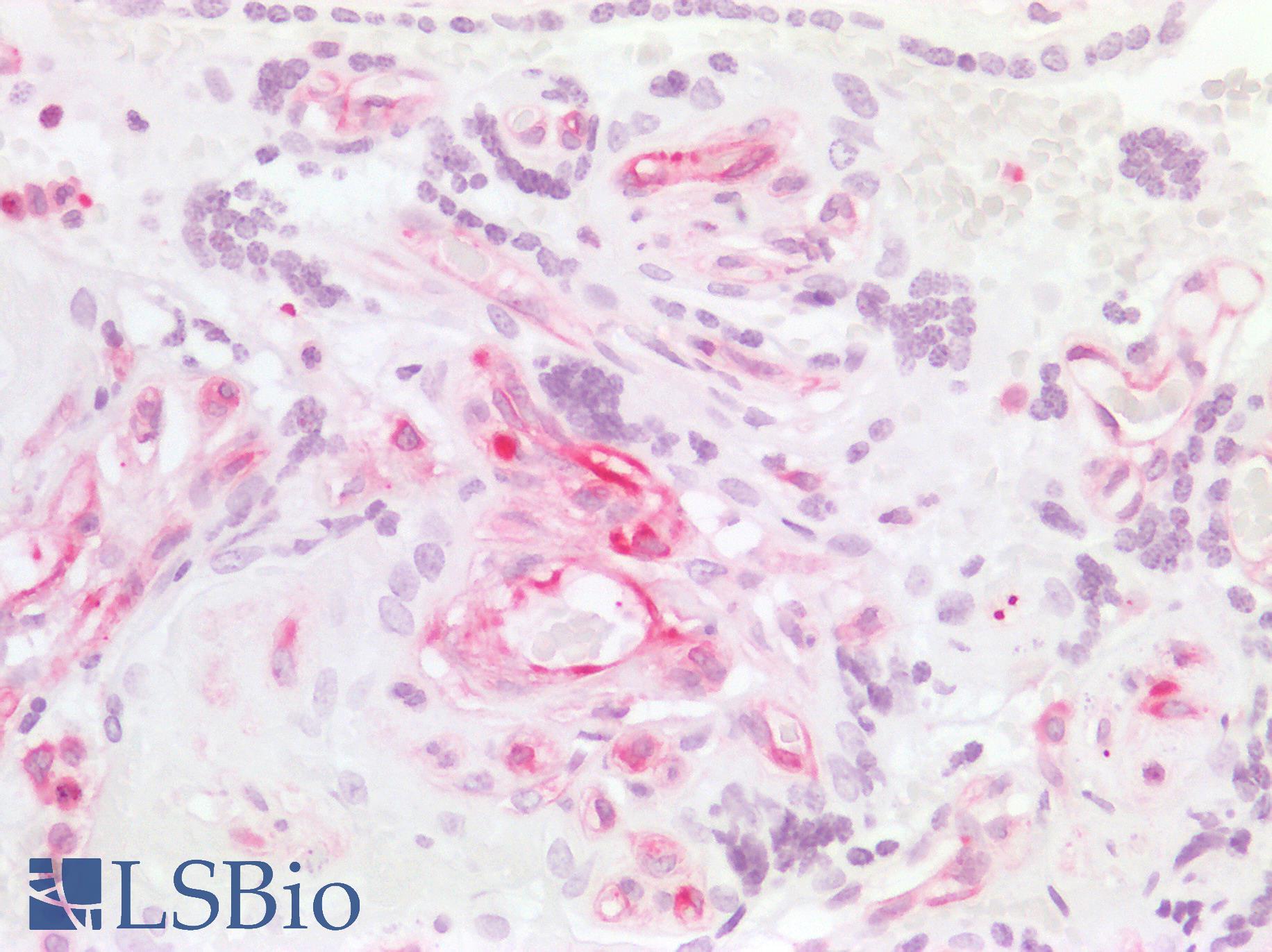 MSN / Moesin Antibody - Human Placenta: Formalin-Fixed, Paraffin-Embedded (FFPE)