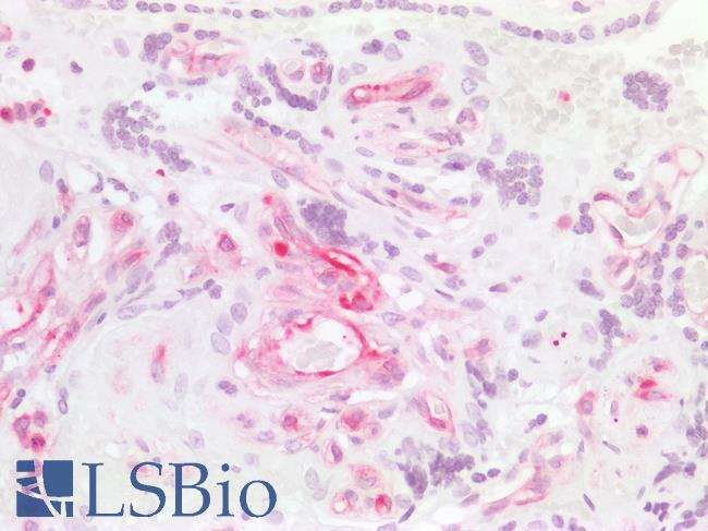 MSN / Moesin Antibody - Human Placenta: Formalin-Fixed, Paraffin-Embedded (FFPE)