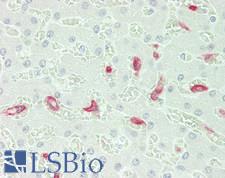 MSR1 / CD204 Antibody - Human Liver: Formalin-Fixed, Paraffin-Embedded (FFPE)